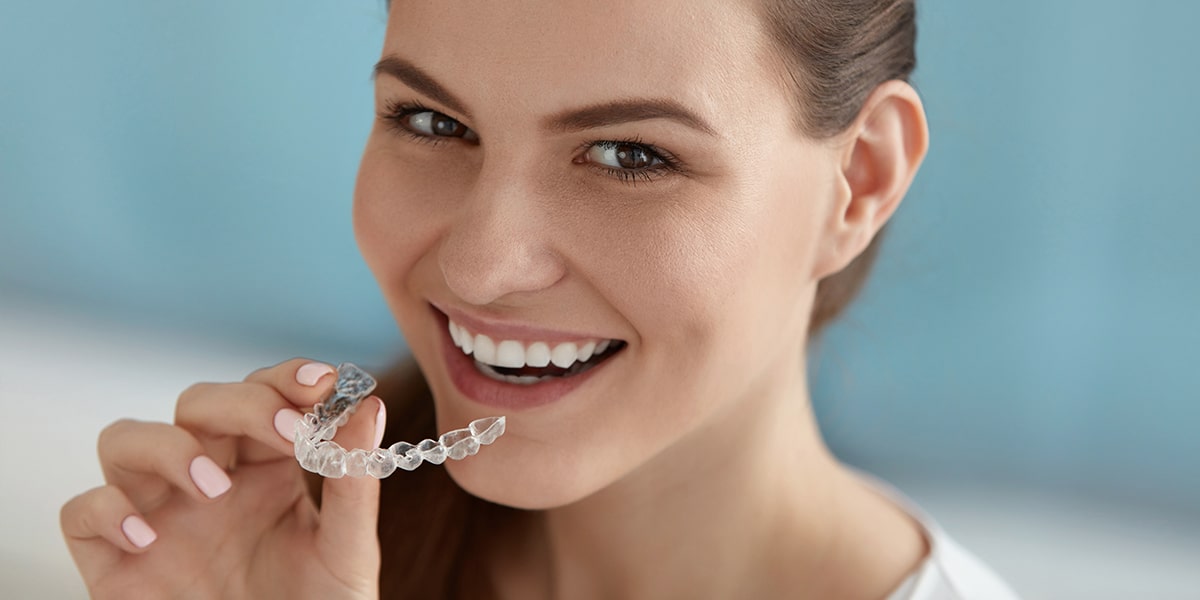 Aligners Image