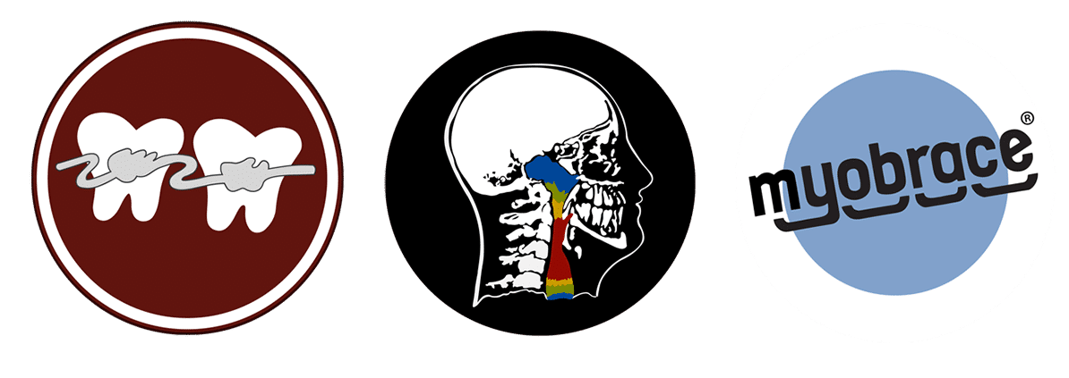 Conventional Orthodontics