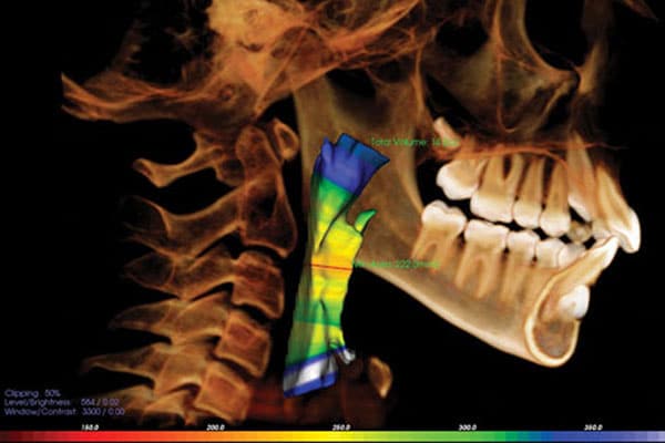 Airway Orthodontics